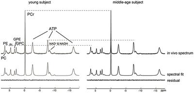 Brain NAD Is Associated With ATP Energy Production and Membrane Phospholipid Turnover in Humans